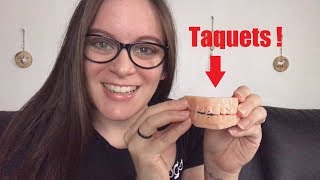 Des taquets ? Je vous explique tout !