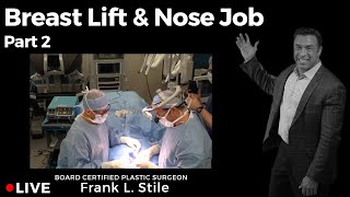 Breast Lift and Nose Job Part 2!