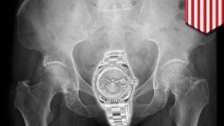 Как надёжно спрятать Rolex за 35 тысяч долларов