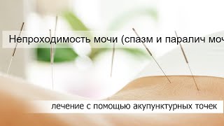 Непроходимость мочи (спазм и паралич мочевого пузыря)