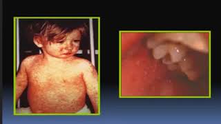 PEDIATRIA 5 CLASES  RESIDENTADO MEDICO