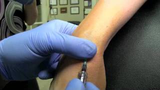 IV infusion start