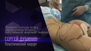 Липоскульптура тела с увеличением ягодиц собственной жировой тканью