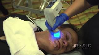 Exilis Elite