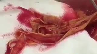 Видео не для слабонервных!!!