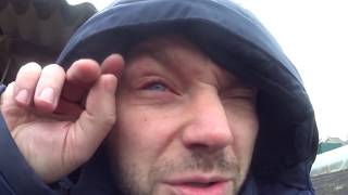 Опасные Петарды,Больница,Потеря Зрения./Firecrackers explosion, vision loss.