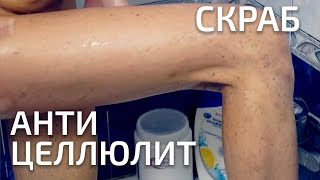 Целлюлит? Скраб для кожи поможет за 3-5 процедур