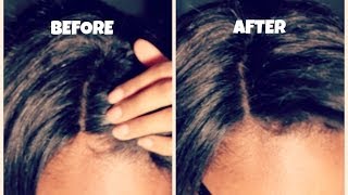 Closure Application| How to Make Your Closure Natural