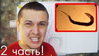 Этот Жгут Вывалится из Вас и будет Напоминать Глиста. 2 часть. Чистка кишечника. Шлангопопинг.