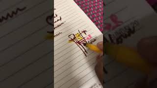 Dr. Pratheepa's radial nerve in spiral groove