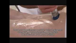 Présentation Storz Medical