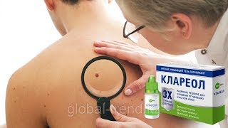 Гель От Папиллом И Бородавок Клареол