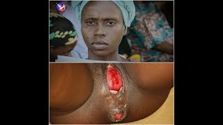 Healing of vagina and anus cancer