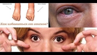 Избавляемся от отеков. Мой опыт .Живая вода . Как вода изменила мою жизнь к лучшему