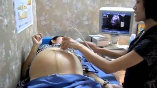 Dernière échographie avant la naissance