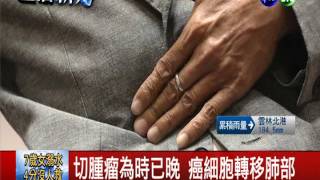 誤以為拉肚子就醫 男罹患胰臟癌