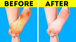 Incredibly Smart Feet Hacks And Shoes Tips