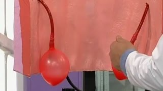 Что такое геморрой