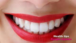 দাঁত সাদা করার উপায় | সহজ ৪ টি ঘরোয়া টিপস | How to Whiten Teeth