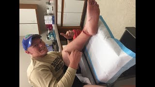 I CUT OFF MY FOOT!!!
