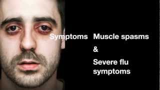 Percocet Addiction & Percocet Abuse