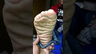 #PhillyFeet???