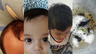 শিশুর মাথায় দ্রুত ঘন চুল বৃদ্ধির উপায় | ঘরে তৈরি তেল | Be A Positive Mom