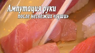 Ампутация руки после несвежих «суши» / Korean man has left hand amputated after eating sushi