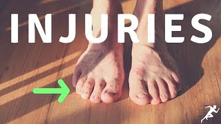 20 Years of Running Injuries Explained and Analyzed