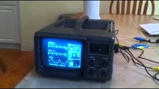 Halloween 2014 - testing the EKG simulation