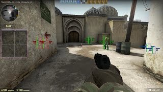 CSGO IS CANCER!! [HACK]