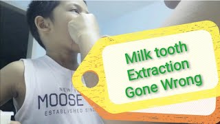 DIY | Milk tooth extraction | watch till end