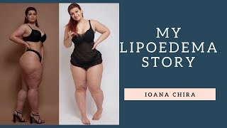 My Lipoedema Story