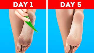 Super Effective Natural Beauty Recipes || Aloe Vera Hacks