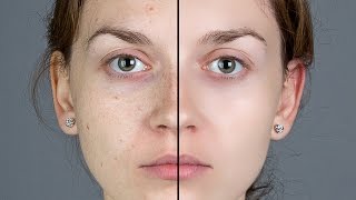 Photoshop Tutorial: How to Quickly Smooth Skin and Remove Blemishes & Scars
