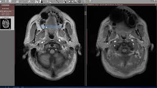 Tutorial  como utilizar RadiAnt DICOM viewer