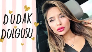 Dudak Dolgusu Yaptırdım | Merak Edilen Her Şey