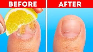 Lemon Power || Beauty Hacks And Cleaning Ideas