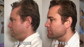 Can This Couple Lose Their Double Chins Together?
