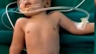 Haneef bhai baby heart ambulance fast driving 2020 new video