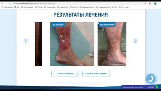 Разбор сайта Flebos Clinic - центр флебологии - увеличение конверсии