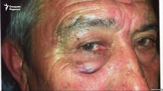 Отаси тенги пенсионерни калтаклаган ДХХ ходими жазосиз қолмоқда