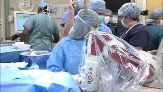 ROSA robot guides new epilepsy procedure