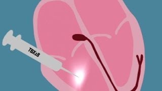 Scientists Create a Biological Pacemaker