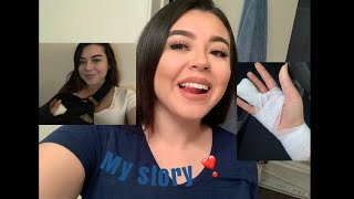 My Amputated  Finger Story