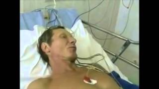 Смерть человека заразившегося бешенством