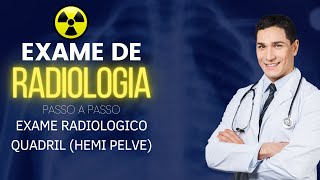 Quadril (Hemi pelve) AP e Obliqua. - Prof Imidio