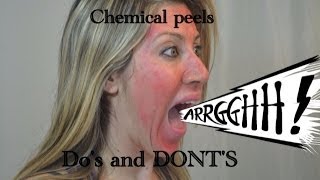Chemical Peels | Do's And Dont's