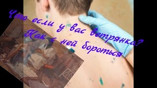 Что если у вас Ветрянка (Ветряная Оспа)