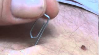A paperclip inside the navel